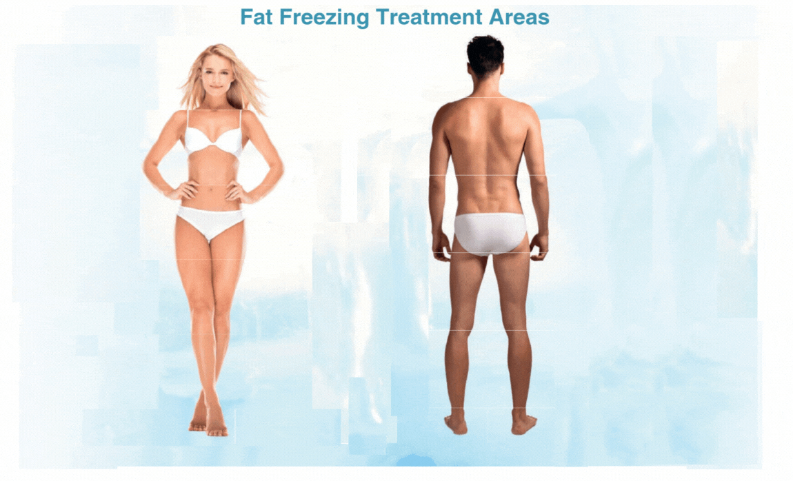 Fat reduction treatment areas for male and female
